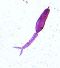 1. What is pictured here, what species is it, what form is it?
2. What is the function of this form of the helminth?
3. From what does this mature and in what intermediate host?