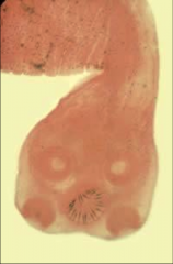 1. What species is pictured here and what category of helminth is this?
2. Describe the morphology.