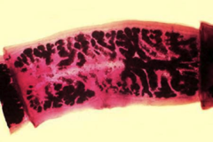 1. What is pictured and what genus and species is this from?

2. Describe the pathogenesis of this in pigs.

3. Describe the pathogenesis of this in humans.
