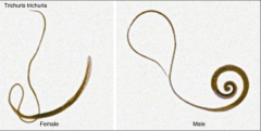 1. Nematode - Roundworm - Trichuris Trichiura - WHIPWORM
2. Worldwide
3. Fecal-oral
