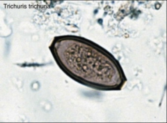 1. Egg of Trichuris Trichiura - WHIPWORM - Nematode, Roundworm

2a. Most are Asymptomatic
2b. Rectal Prolapse, Dysentery, Developmental Deficits

3. Children

4. Fecal Smears - Mebendazole