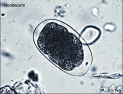 1. Necator Americanus - HOOKWORM - Nematode, Roundworm

2. Intestinal Blood Loss - Iron Deficiency Anemia

3. Find Eggs (PICTURED) in the feces

4. Mebendazole