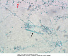 1. Trichophyton - Cutaneous Skin Mycosis

2. Abundant Microconidia with a few macroconidia

3. Pencil-shaped with smooth walls