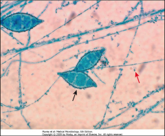 1. What is pictured here? What category of Mycosis is this?

2. Describe the morphology. Which is the micro and which is the macroconidia?