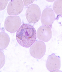 1. What is the amoeboid figure pictured here and in what phase?

2. What becomes of the cytoplasm in this cell?

3. What test would we do to visualize this?