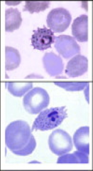 1. Which strain of Plasmodium and form is pictured here?

2. How can you tell?