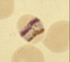 1. Which strain of Plasmodium and form is pictured here?