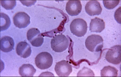 1. What is pictured here? Describe the morphology.

2. What do they infect and what form do they take?