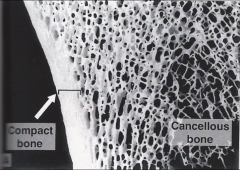 Cortical compact bone and the trabeculae of cancellous (spongy) bone