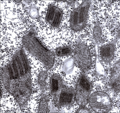 Paracrystalline (parking lot) inclusions in mitochondria (EM)

-think mitochondrial myopathy