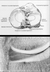 *Main function is to protect the articular cartilage
*Semicircular
*Wedge x-section
*Conforms tibia-femoral articular surfaces
*Attached peripherally to capsule, tapers to free edge in joint