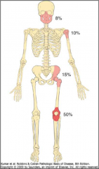 Major sites of Origin – note large percentage near the knee.