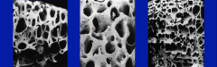 Trabecular Bone (Cancellous or spongy bone)