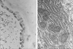 -osteoblasts on left (normal)
-right: mitos and RER synthesizing osteoid in OBs