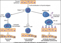 Pathogenesis of Hashimoto Thyroiditis: