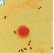 Lancet-shaped, gram-positive diplococci. 

Encapsulated. IgA protease.

Pneumococcus is associated with "rusty" sputum, sepsis in sickle cell anemia and splenectomy.

No virulence without capsule.