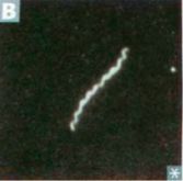 Treponeme of syphilis visualized through dark-field microscopy.
