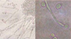 Candida albicons. Dimorphic yeast. 

Pseudohyphae and budding yeasts at 20˚C (left).
Germ tubes at 37˚C (right)