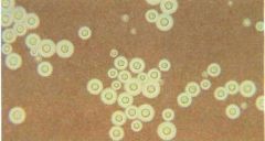Cryptococcus neoformans. 5-10 µm yeasts with wide capsular halos and unequal budding in lndia ink stain.