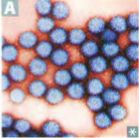 Rotavirus, the most important global cause of infantile gastroenteritis, is a segmented dsRNA virus (a reovirus). 

Major cause of acute diarrhea in the United States during winter, especially in day-care centers, kindergartens. 

Villous dest...