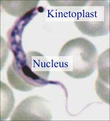 -widespread parasites
-“Old world” (Africa): cattle, sheep, goats, wild game, humans
-New world (S. America): cats, dogs, armadillo, humans

-unifying feature = kinetoplast (mitochondrial DNA)
-flagella
-Giemsa staining