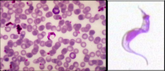-Giemsa stain
-We won't be able to tell. Experts can.