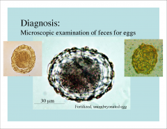 -eggs with larvae of ascaris lumbricoides.