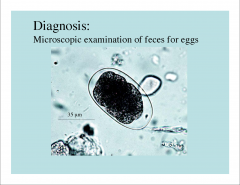 -thin shell
-eggs are in feces