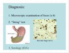 -No eggs in the stool
-serology is best (but presence of Abs in not always clear)
