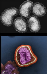 Orthomyxovirus (flu)