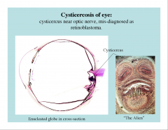 -alien appearance is a cross section of a cysticercus