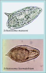 -schistosoma mansoni - hook on side, infects GI/Liver
-schistosoma haemaToBium - hook at tip, infects bladder