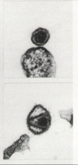top: C-type (HTLV)
bottom: D-type (HIV)