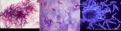 Left: Actinomycetes
Middle: Mycoplasma shown w/ acid fast stain.
Right: Spirochetes; thin

*Special shapes/staining properties
-Acid-fast bacteria
-Spirochetes
-Mycoplasma (no CW)
-Chlamydiae and Rickettsiae (obligate intracellular parasites)
-Ac