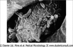 Adherence of Vibrio cholerae to M cells in human ileal mucosa.