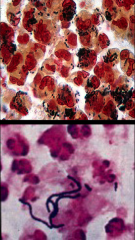 Top: Staph in clusters
Bottom: Strep in chains
*Both gram + cocci.