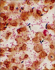 *Large, Gram-positive anaerobic rod with square ends.
*Most common species of Clostridium isolated from   clinical specimens.

*Ubiquitous in nature; part of normal flora of vagina and GI tract; spores are found in soil but rarely seen in body.

*Maj