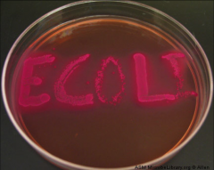 C. Escherichia coli

*Only one that ferments lactose
*Test aids in the identification of pathogens among normal flora.
*Most enteric bacteria ferment lactose including E. coli--> show up red.
*Primary enteric pathogens (i.e Shigella, Salmonella, and 