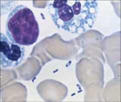Plague bacillus in Peripheral blood smear
Wright-Giemsa Stain