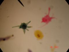 Name the phylum and the genus. Point out the pseudopod.