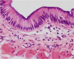 Lines gastrointestinal tract (stomach to anus) ducts of glads and gallbladder

Secretion and Absoption