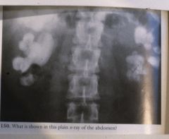 What is wrong with the person in this x-ray?  How do you know?
