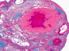 What structure within the ovary is pictured here?
 