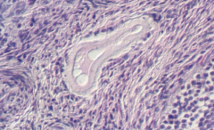 What structure within the ovary is pictured here?