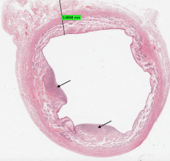 Identify the structure indicated in the uterus
 