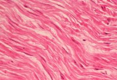 What is the role of smooth muscle?