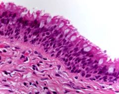 What is the role of ciliated epithelium?