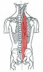 A deep muscle in the back that is responsible for extending the spine and raising the head.