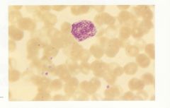 These are red/purple particles seen in neutrophils, basophils, and eosinophils. They can resemble toxic granulation.