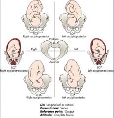 **relationship of denominator (landmark) of the presenting part to the four quadrants of the mother's pelvis

"junk in the trunk"
1/ baby on R or L side of mother's pelvis?
2/ landmark/presenting part? think of fetal attitude
3/ is the butt/s...